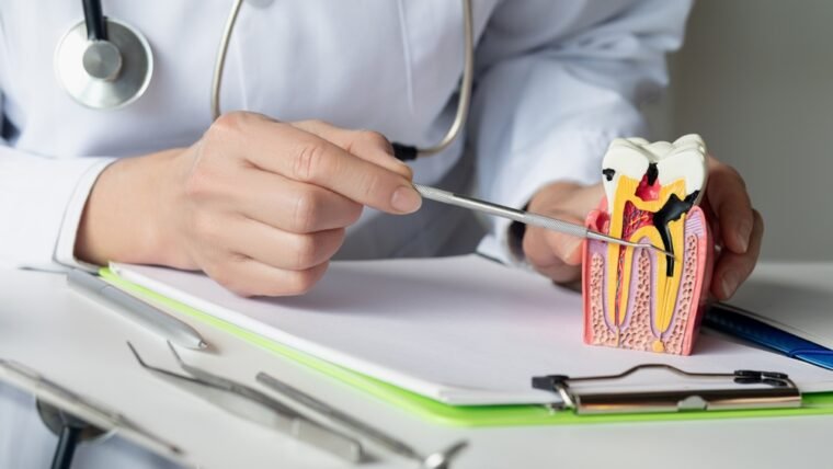 How To Avoid Root Canal