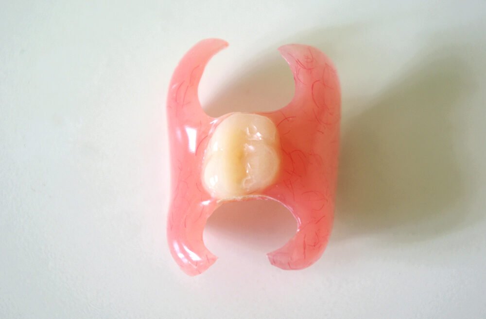 One Tooth Partial Denture