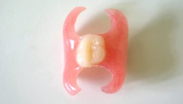 One Tooth Partial Denture