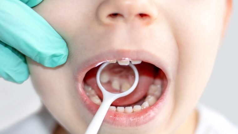 Dentistry For Children