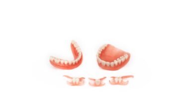 1 Tooth Partial Denture