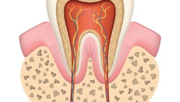 How Much Is A Root Canal In Ontario