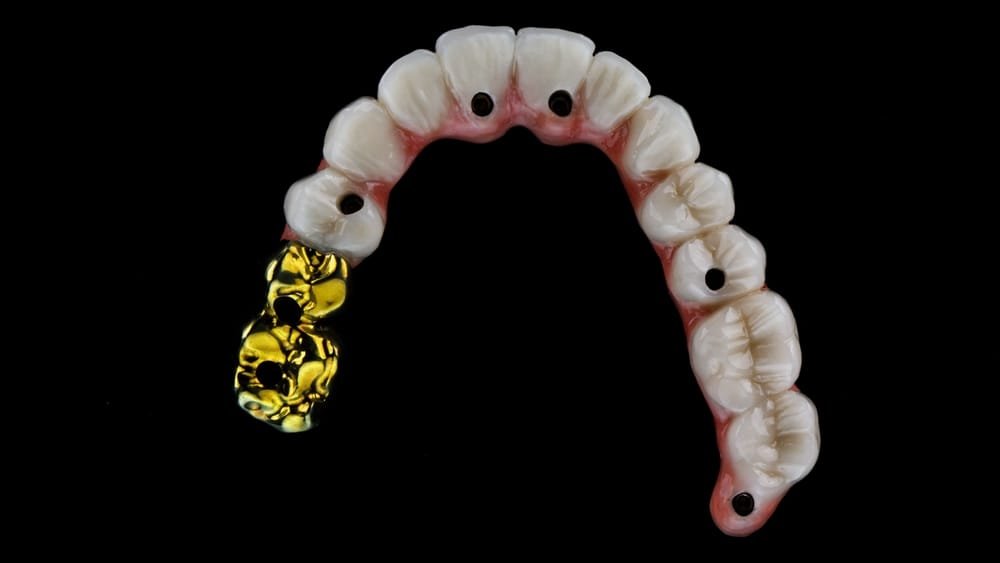 Gold Denture Teeth