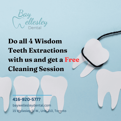 Do all 4 Wisdom teeth Extractions with us and get a free Cleaning session
