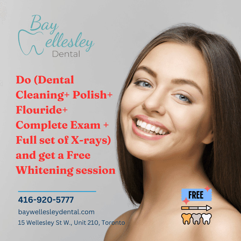 Summer Promotions for dental service2 Do (Dental Cleaning+ Polish+ Flouride+ Complete Exam + Full set of X-rays) and get a free Whitening session
